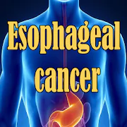 Esophageal Cancer  APK 0.0.1