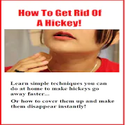 How To Get Rid Of A Hickey