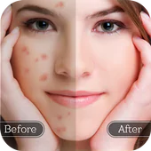 Face Blemish Remover - Smooth Skin & Beautify Face